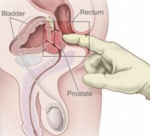 Lingam – Male Prostate Massage